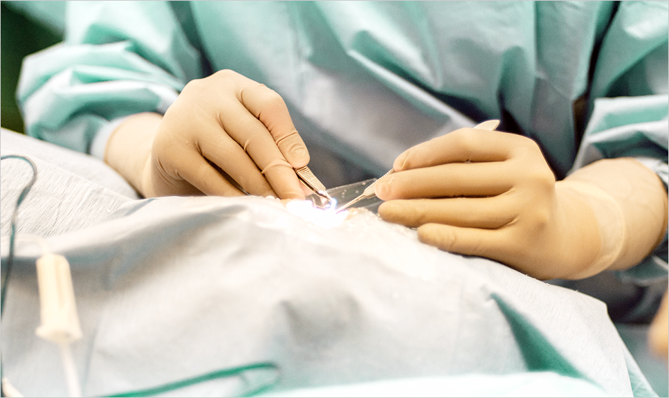 Manos de médico oftalmólogo realizando cirugía de cataratas.