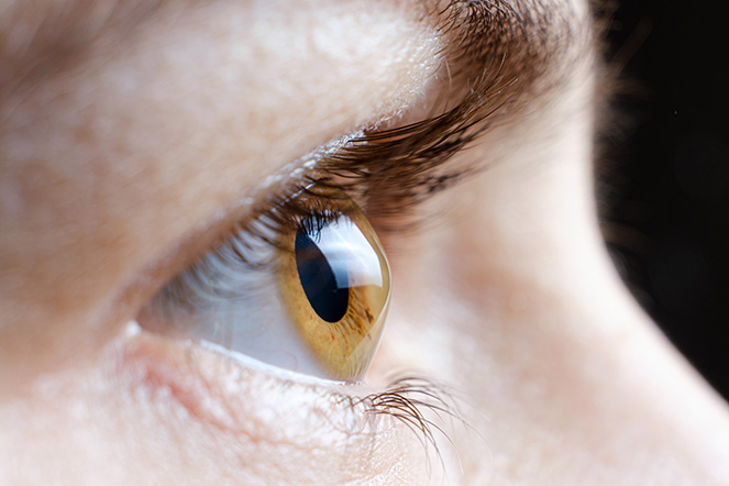 Vista de perfil de un ojo con queratocono