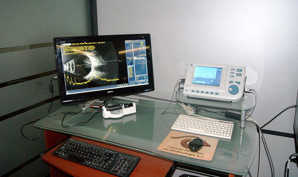 Equipo de ultrasonido ocular